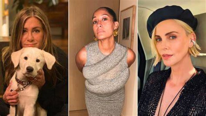 15 Celebs Who Are Scarred For Life, Literally
